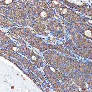 Anti-SFXN5 Antibody
