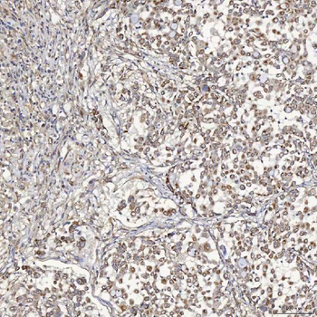 Anti-SFXN5 Antibody