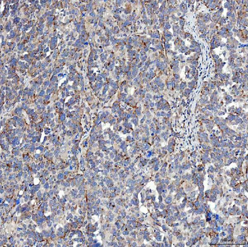 Anti-SFXN5 Antibody