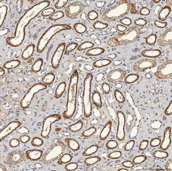 Anti-SFXN5 Antibody