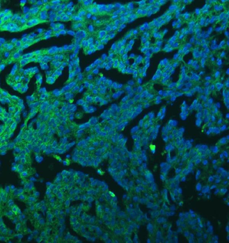 Anti-SFXN3 Antibody