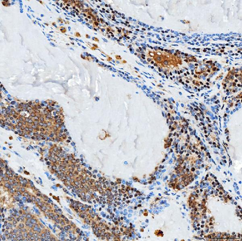 Anti-SFXN3 Antibody