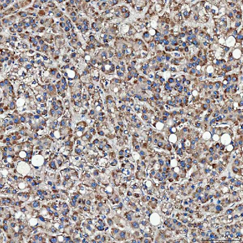 Anti-SFXN3 Antibody