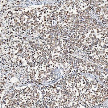 Anti-SFXN3 Antibody