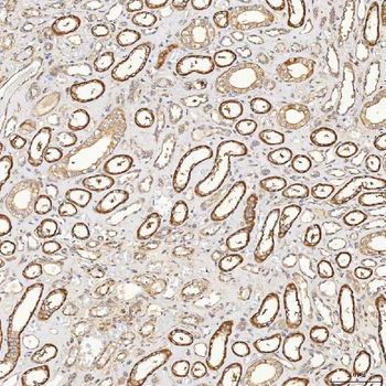 Anti-SFXN3 Antibody