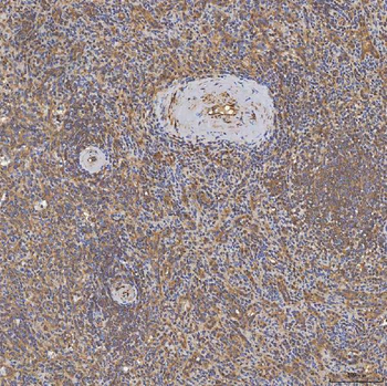 Anti-SFXN3 Antibody