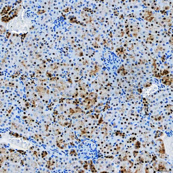 Anti-SF3A3 Antibody