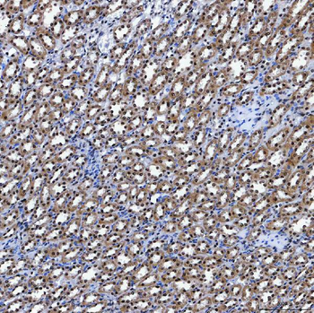 Anti-SF3A3 Antibody