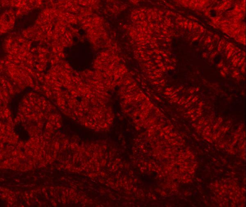 Anti-SF3A3 Antibody