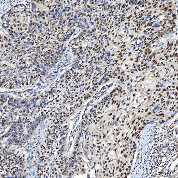 Anti-SF3A3 Antibody