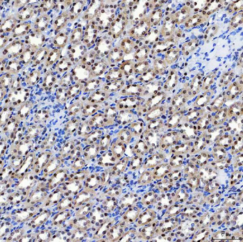 Anti-SF3A1 Antibody