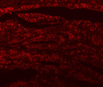 Anti-SF3A1 Antibody