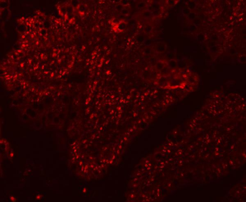 Anti-SF3A1 Antibody
