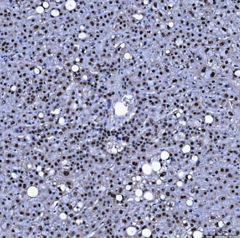 Anti-SF3A1 Antibody
