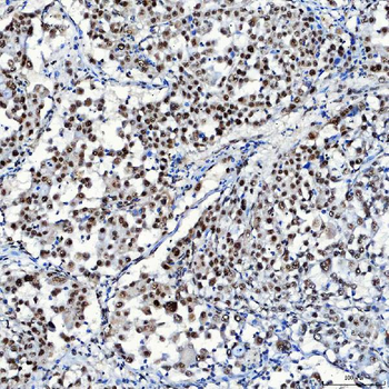 Anti-SF3A1 Antibody