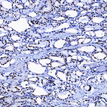 Anti-SF3A1 Antibody