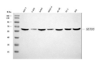 Anti-SETD3 Antibody
