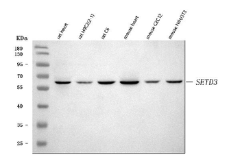Anti-SETD3 Antibody