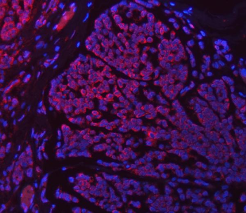 Anti-SETD3 Antibody