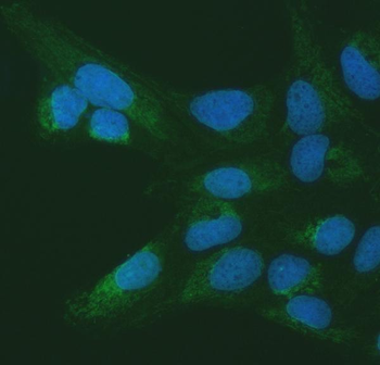 Anti-SETD3 Antibody