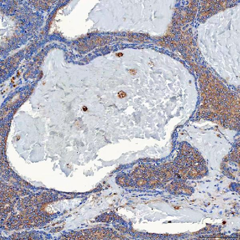 Anti-SETD3 Antibody