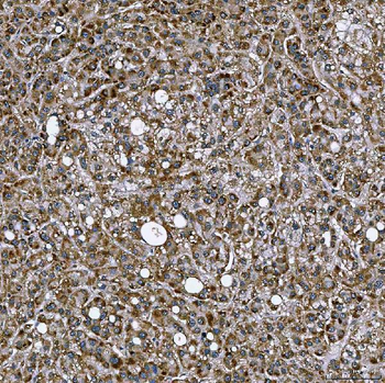 Anti-SETD3 Antibody