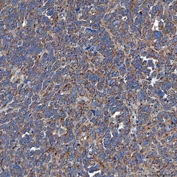 Anti-SETD3 Antibody