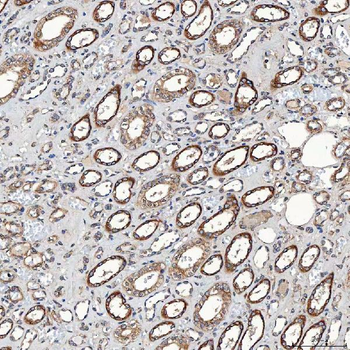 Anti-SETD3 Antibody