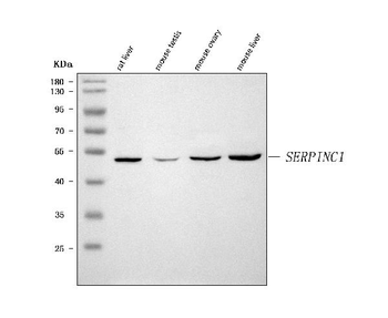 Anti-Antithrombin III/SERPINC1 Antibody