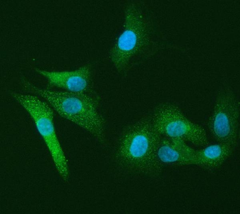 Anti-PI2/SERPINB1 Antibody