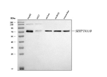 Anti-ZPI/SERPINA10 Antibody