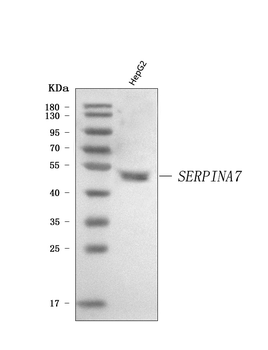 Anti-Thyroxine Binding Globulin/SERPINA7 Antibody
