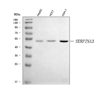 Anti-AACT/SERPINA3 Antibody