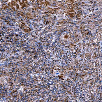 Anti-SERAC1 Antibody