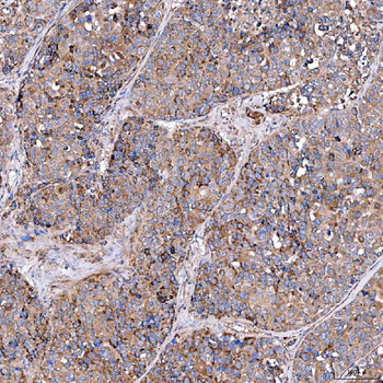 Anti-SERAC1 Antibody