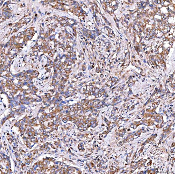 Anti-SERAC1 Antibody