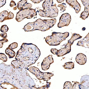 Anti-SERAC1 Antibody