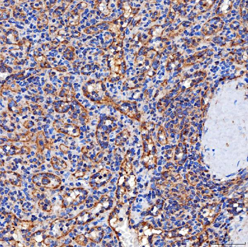 Anti-SERAC1 Antibody