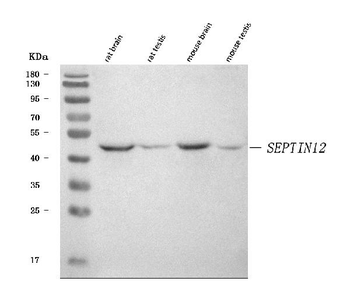 SEPTIN12 Rabbit Polyclonal Antibody