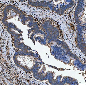 Anti-SEMA4F Antibody