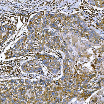 Anti-SEMA4F Antibody