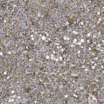 Anti-SEMA4F Antibody