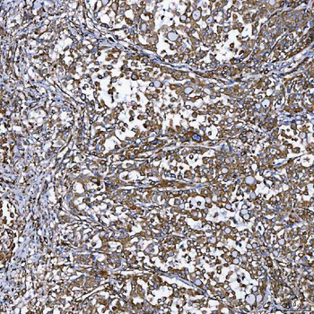 Anti-SEMA4F Antibody