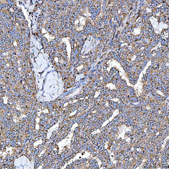 Anti-SEMA4F Antibody