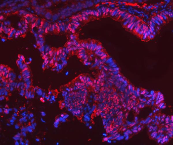 Anti-SBP/SELENBP1 Antibody