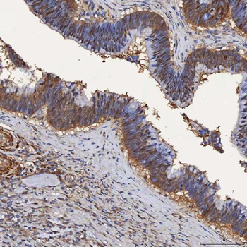 Anti-SBP/SELENBP1 Antibody