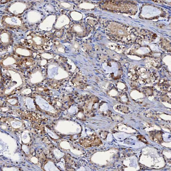 Anti-SBP/SELENBP1 Antibody