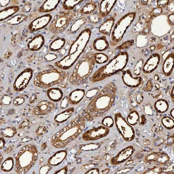 Anti-SBP/SELENBP1 Antibody