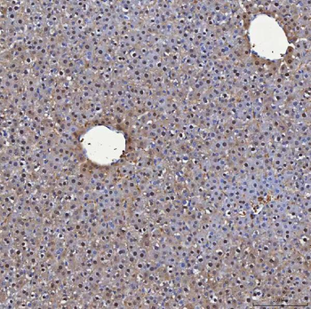 Anti-SBP/SELENBP1 Antibody