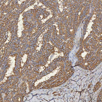 Anti-SEC31A Antibody